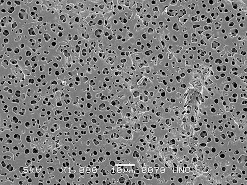 Внешняя поверхность мембраны под микроскопом